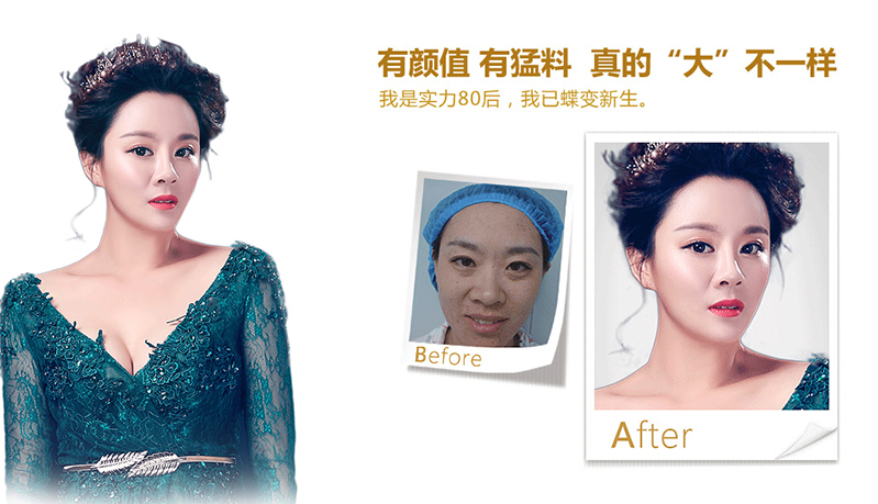 荆州脂肪移植、隆鼻