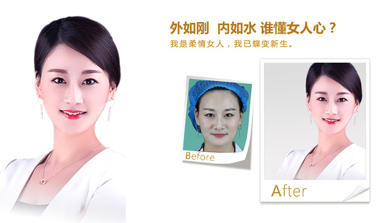 荆州V脸、线雕隆鼻